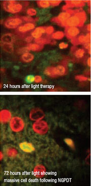 light_therapy light_therapy