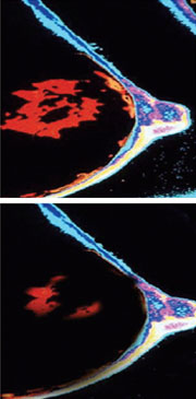 nir_imaging nir_imaging
